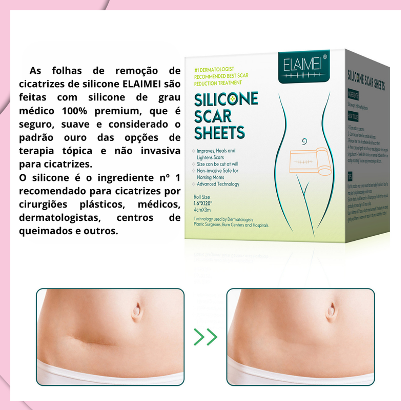Folhas de Silicone Redutoras de Cicatrizes - ELAIMEI