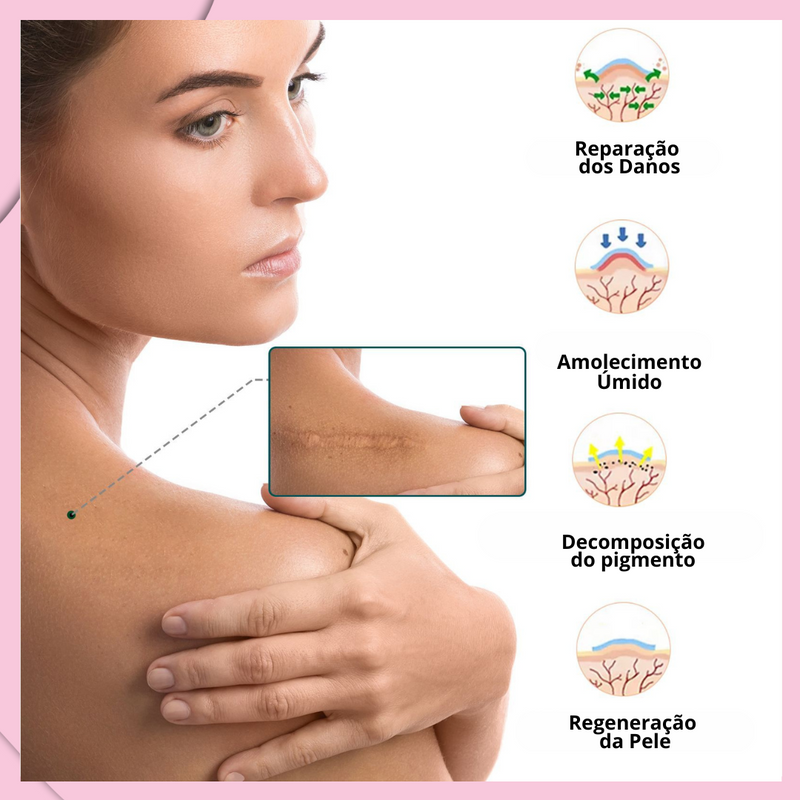 Folhas de Silicone Redutoras de Cicatrizes - ELAIMEI