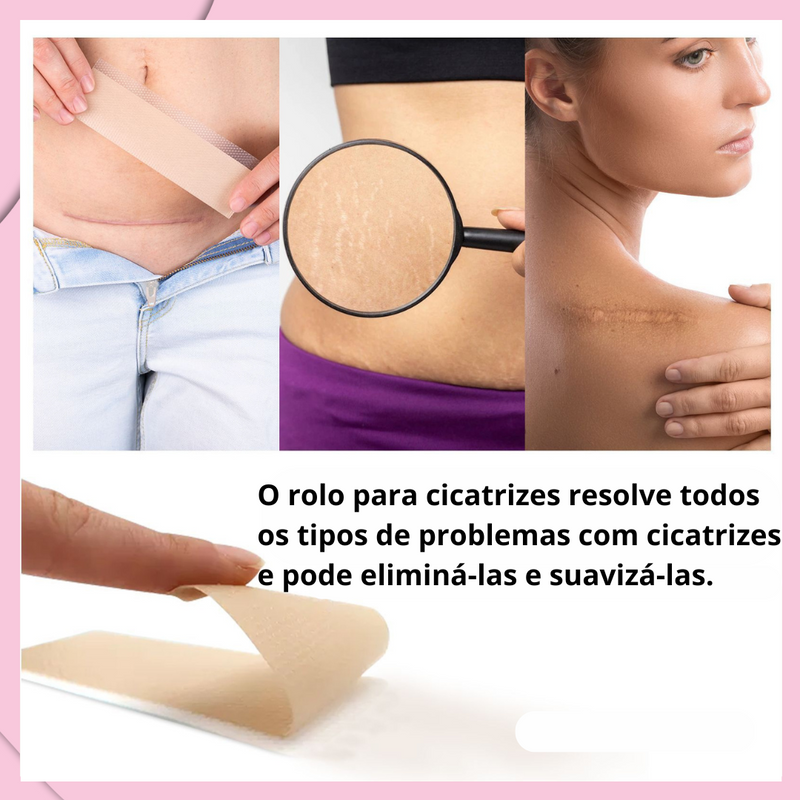 Folhas de Silicone Redutoras de Cicatrizes - ELAIMEI