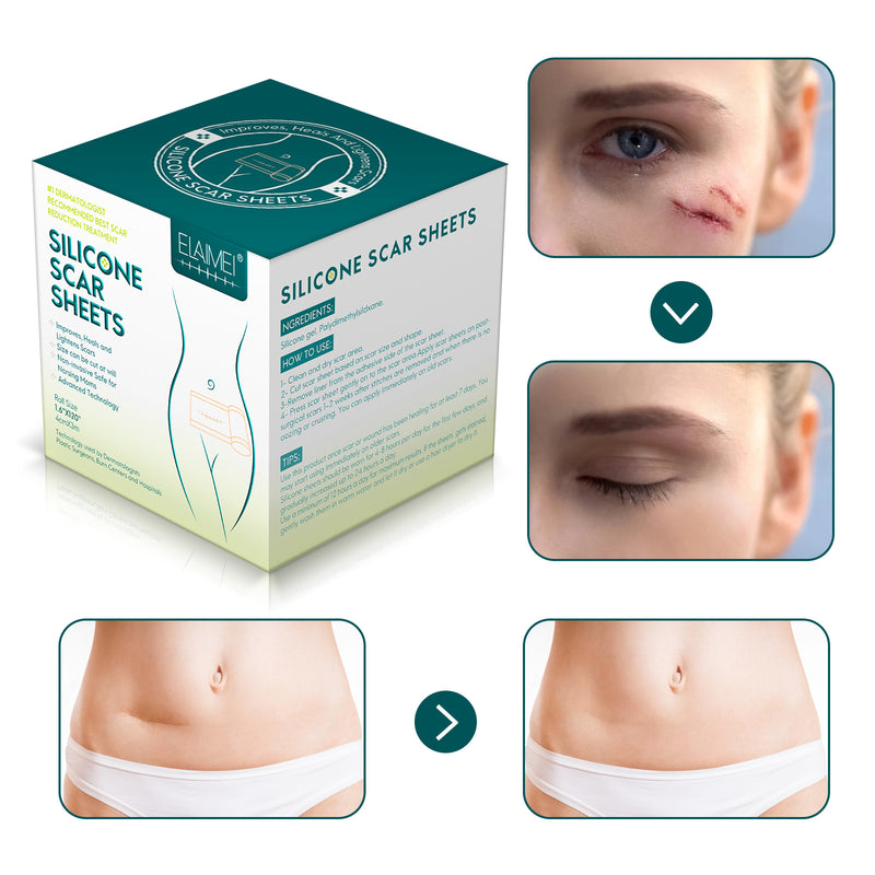 Folhas de Silicone Redutoras de Cicatrizes - ELAIMEI
